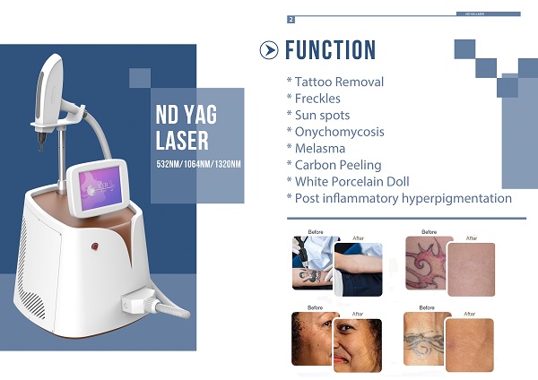 Q-Switched Nd YAG Laser Tattoo Removal Machine 532nm1064nm 1320nm